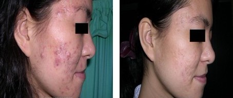 ��������